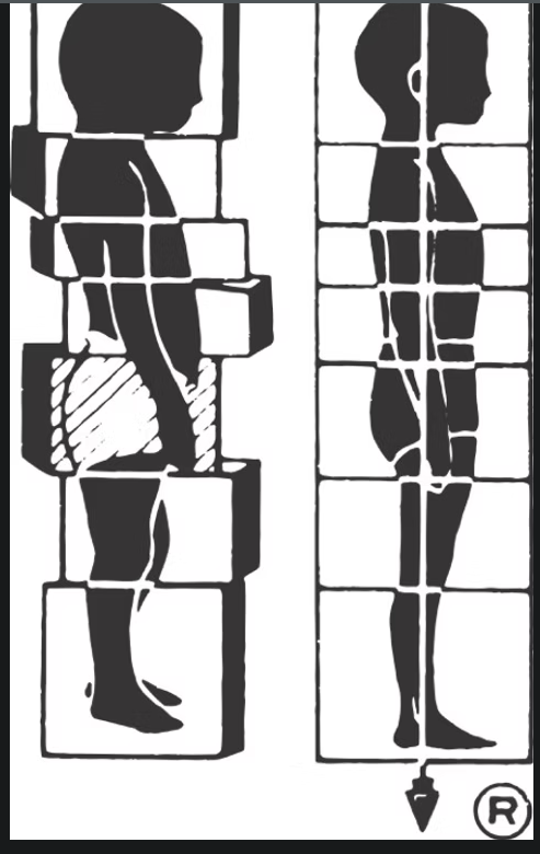 Diagram comparing a body unevenly supported by mismatched, tilted blocks to one aligned along a single straight vertical line — illustrating the postural realignment Rolfing works toward.
